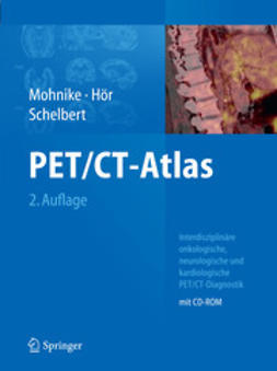 Mohnike, Wolfgang - PET/CT-Atlas, ebook