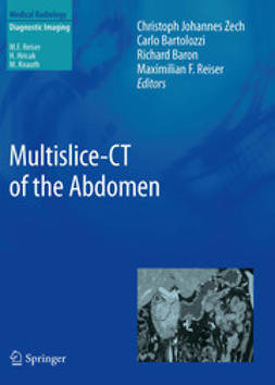 Zech, Christoph Johannes - Multislice-CT of the Abdomen, e-kirja