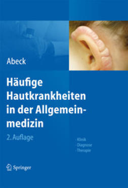 Abeck, Dietrich - Häufige Hautkrankheiten in der Allgemeinmedizin, e-bok