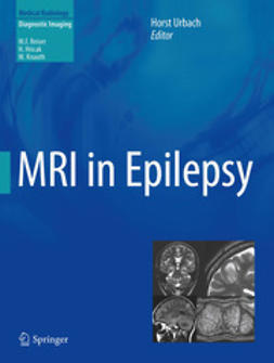 Urbach, Horst - MRI in Epilepsy, ebook
