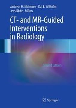 Mahnken, Andreas H. - CT- and MR-Guided Interventions in Radiology, e-bok