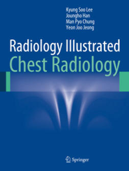 Lee, Kyung Soo - Radiology Illustrated: Chest Radiology, e-bok