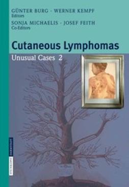 Burg, Günter - Cutaneous Lymphomas Unusual Cases 2, ebook