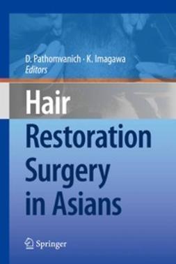 Pathomvanich, Damkerng - Hair Restoration Surgery in Asians, e-bok