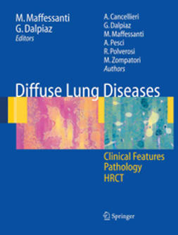 Cancellieri, Alessandra - Diffuse Lung Diseases, e-bok