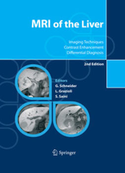 Grazioli, Luigi - MRI of the Liver, ebook