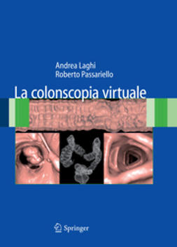 Laghi, Andrea - La colonscopia virtuale, ebook