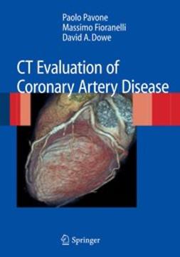 Dowe, David A. - CT Evaluation of Coronary Artery Disease, ebook