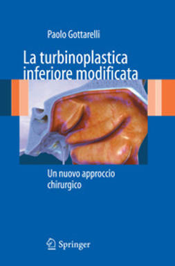 Gottarelli, Paolo - La turbinoplastica inferiore modificata, ebook