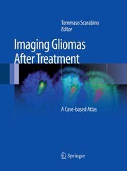 Scarabino, Tommaso - Imaging Gliomas After Treatment, ebook