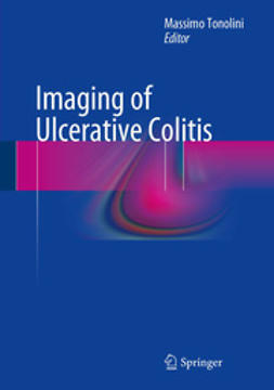 Tonolini, Massimo - Imaging of Ulcerative Colitis, e-bok