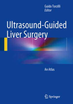 Torzilli, Guido - Ultrasound-Guided Liver Surgery, e-bok