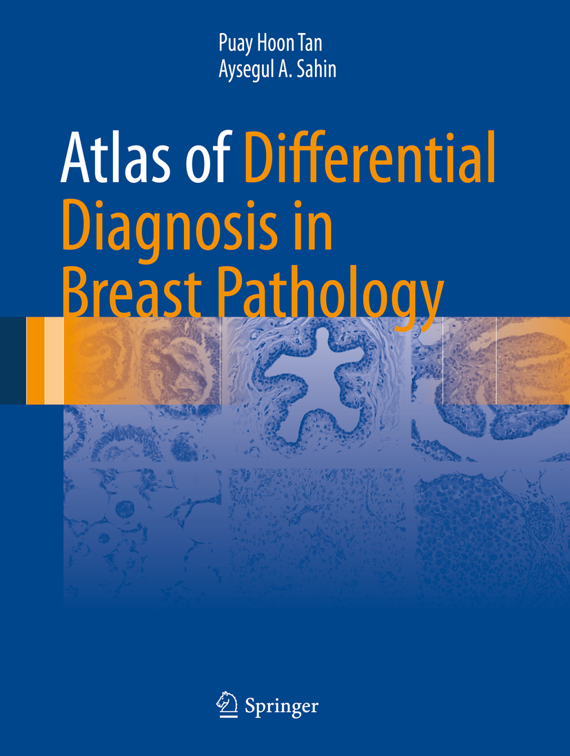 Sahin, Aysegul A. - Atlas of Differential Diagnosis in Breast Pathology, ebook