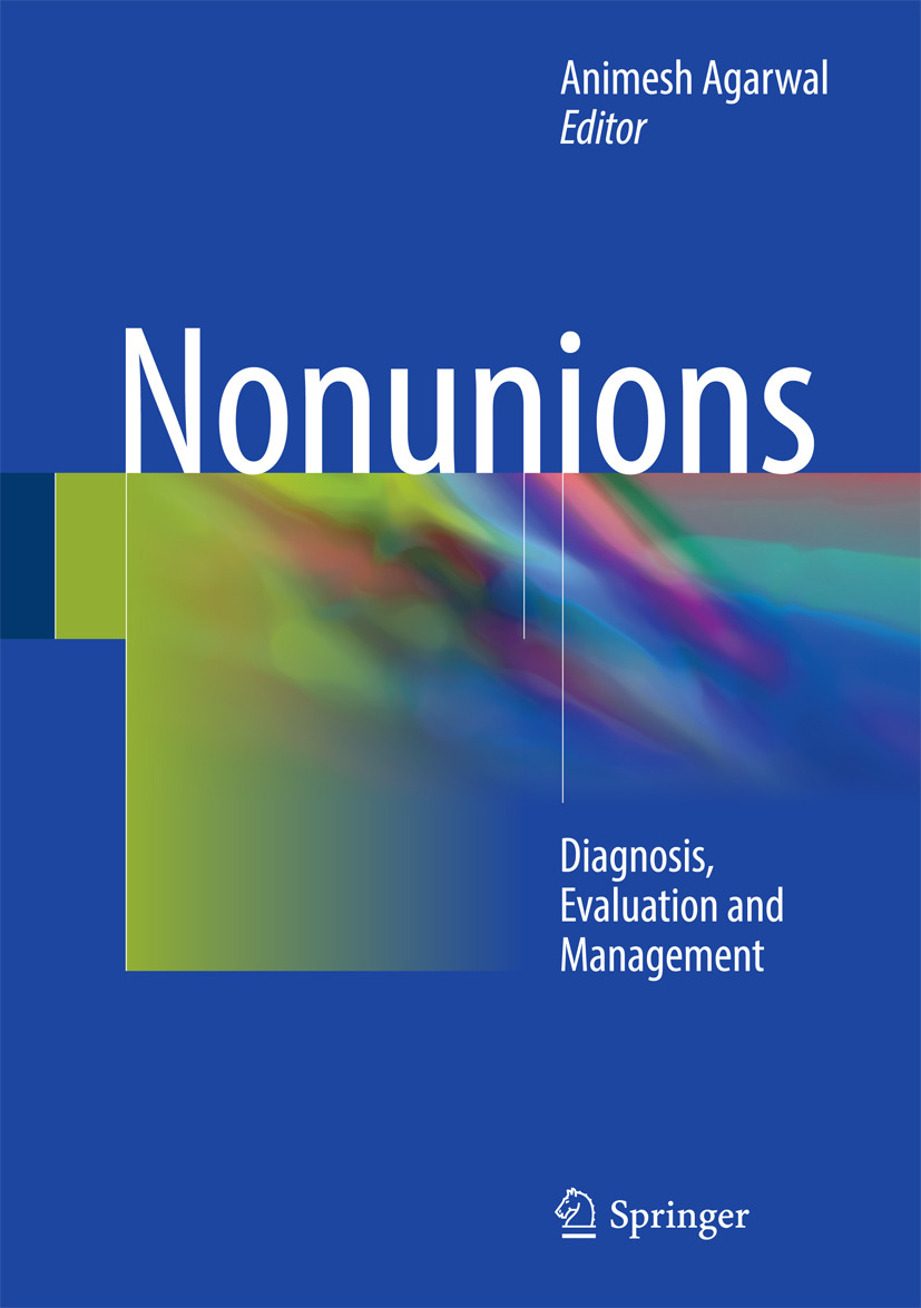 Agarwal, Animesh - Nonunions, e-bok