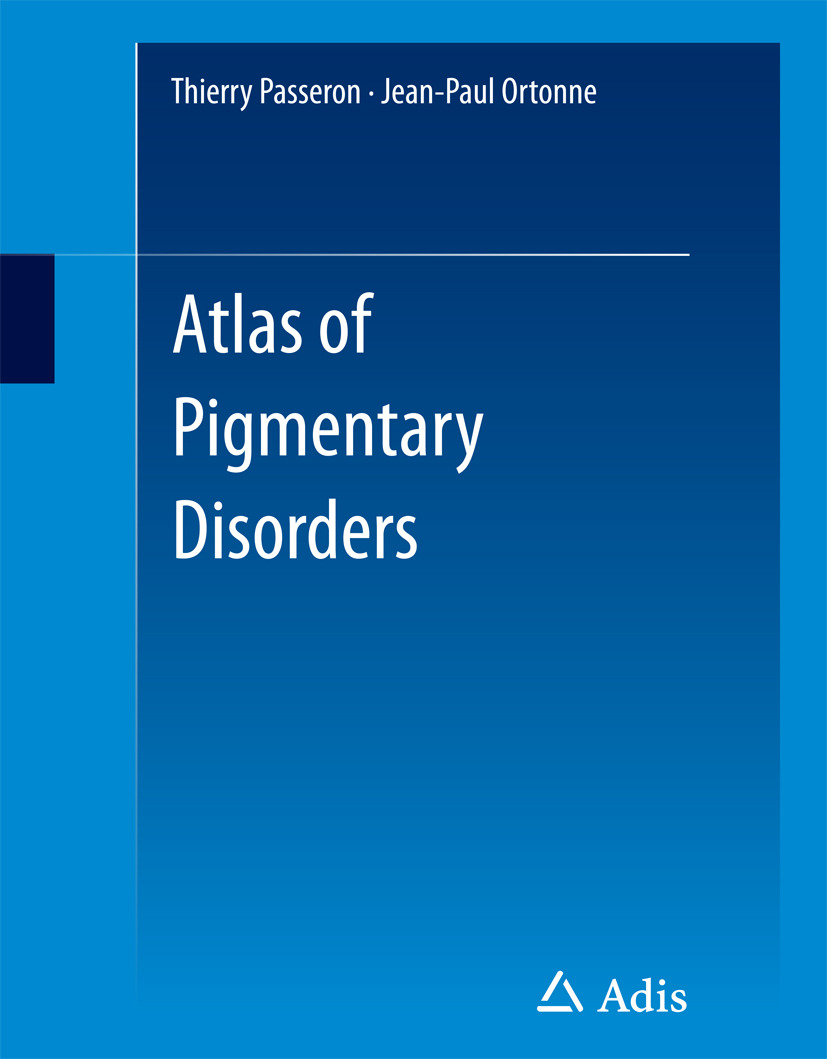 Ortonne, Jean-Paul - Atlas of Pigmentary Disorders, e-kirja