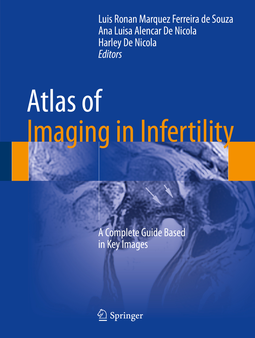 Nicola, Ana Luisa Alencar De - Atlas of Imaging in Infertility, ebook