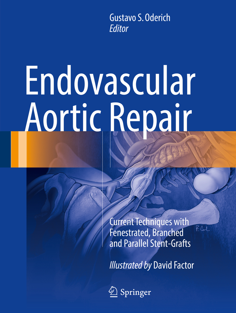 Oderich, Gustavo S. - Endovascular Aortic Repair, e-kirja