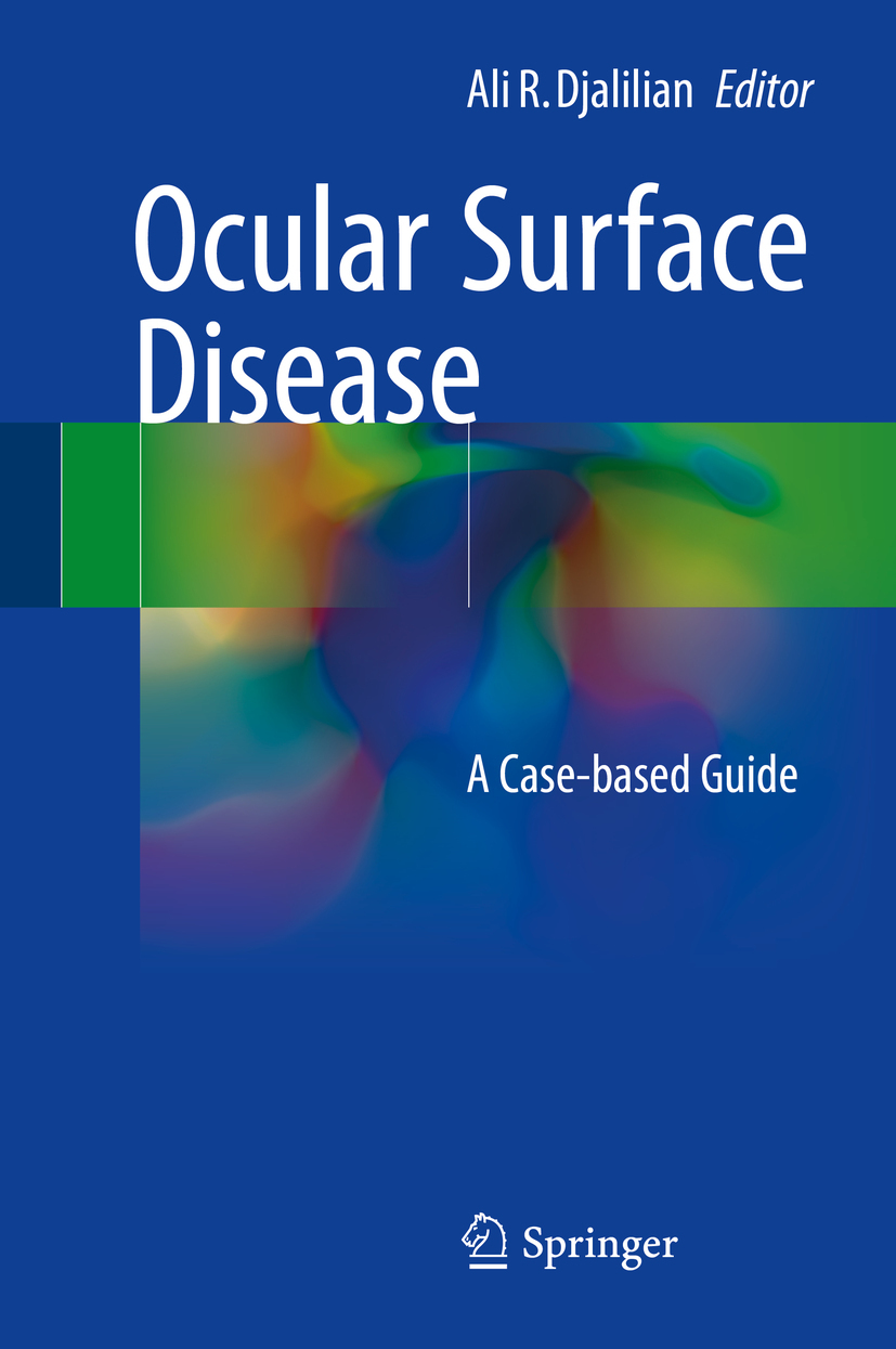 Djalilian, Ali R. - Ocular Surface Disease, e-bok