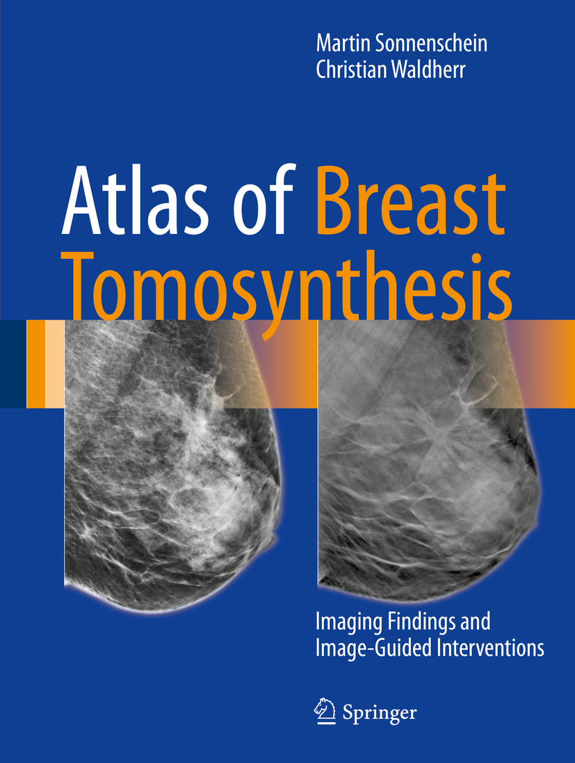 Sonnenschein, Martin - Atlas of Breast Tomosynthesis, e-bok