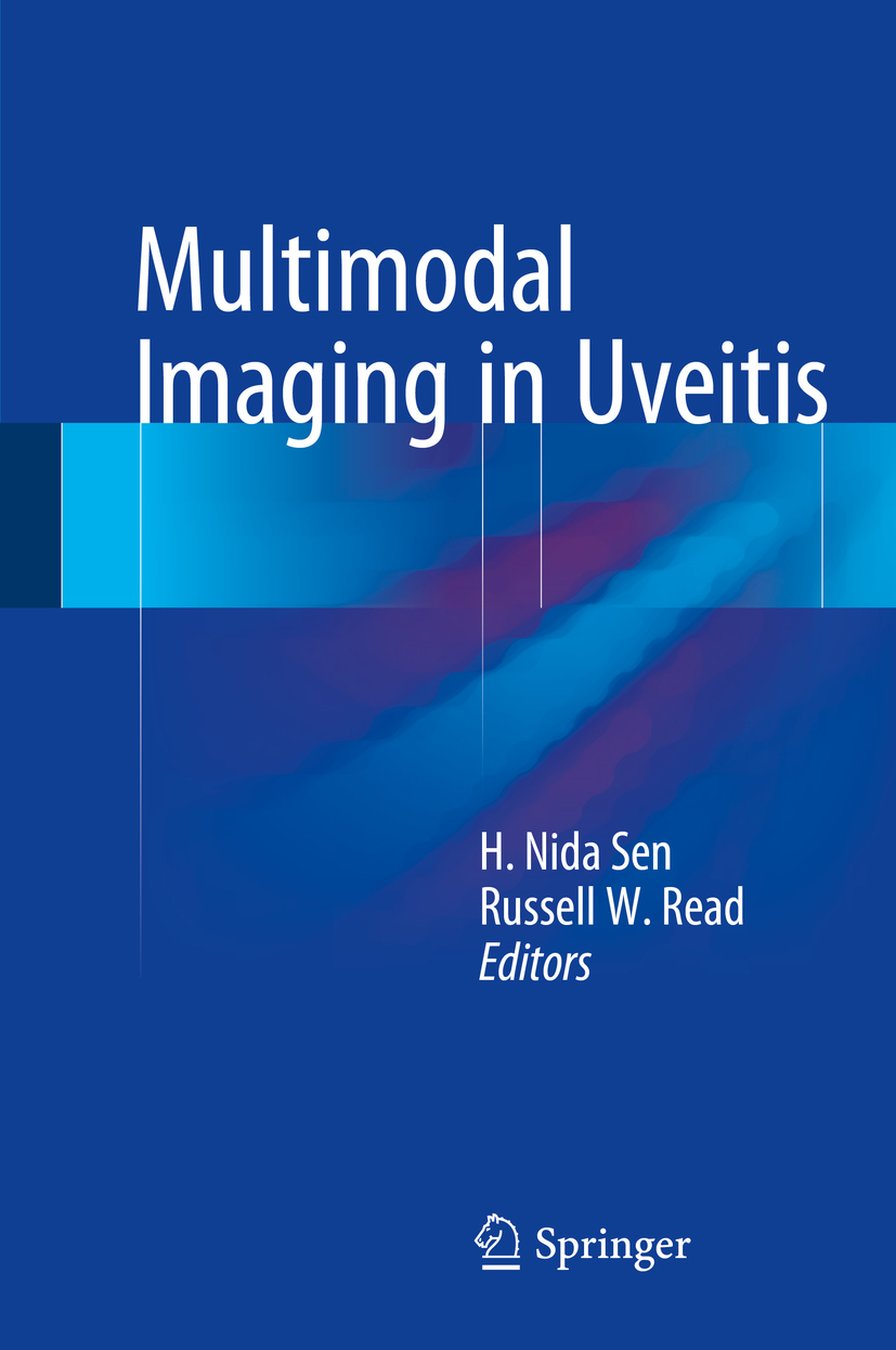 Read, Russell W. - Multimodal Imaging in Uveitis, e-bok