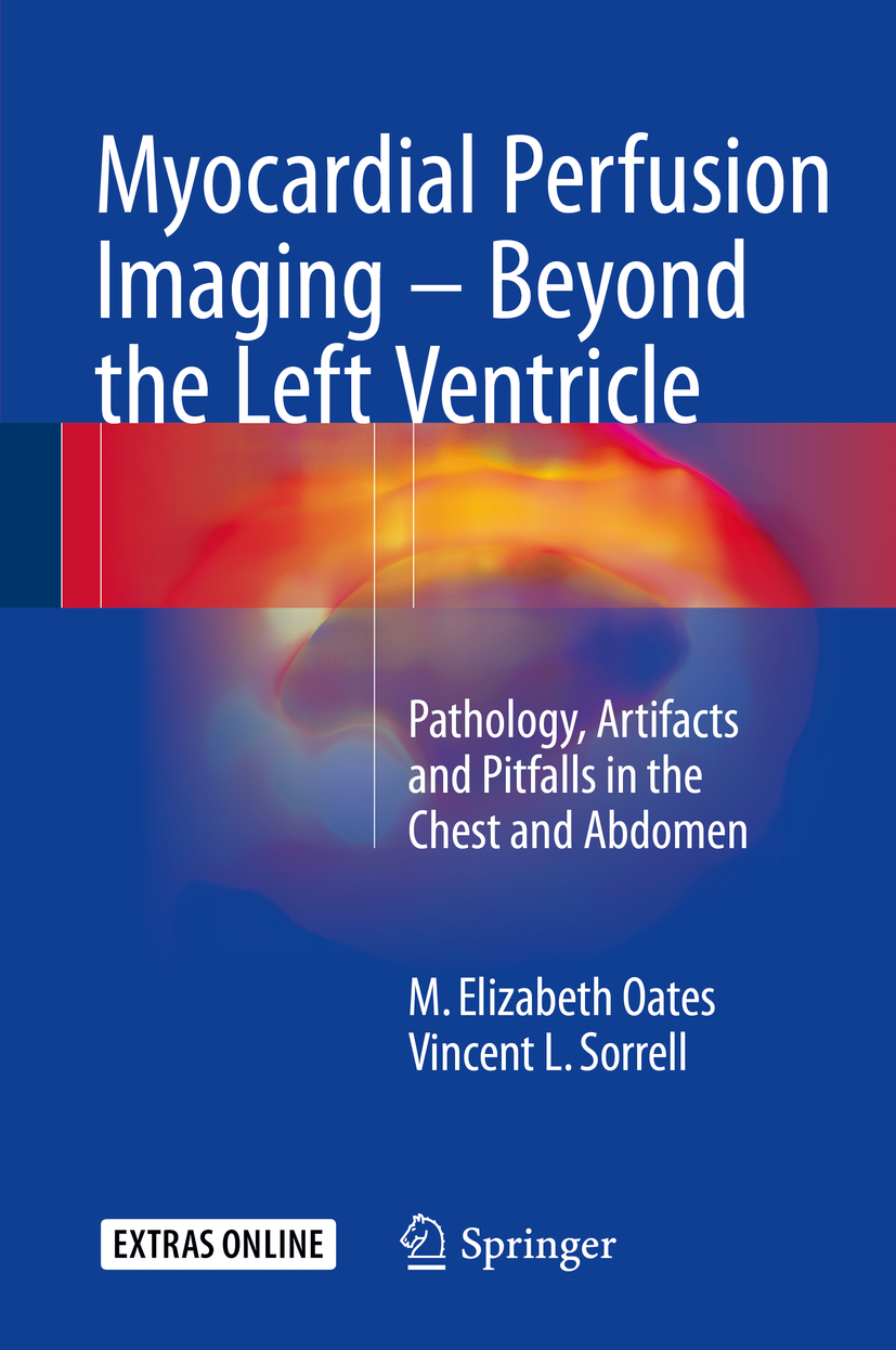 Oates, M. Elizabeth - Myocardial Perfusion Imaging - Beyond the Left Ventricle, e-kirja
