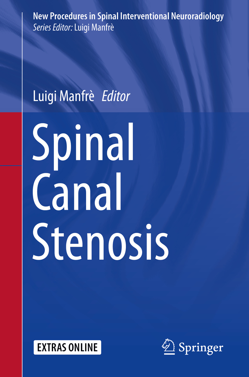 Manfrè, Luigi - Spinal Canal Stenosis, ebook