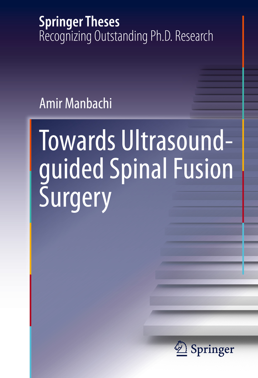 Manbachi, Amir - Towards Ultrasound-guided Spinal Fusion Surgery, e-bok