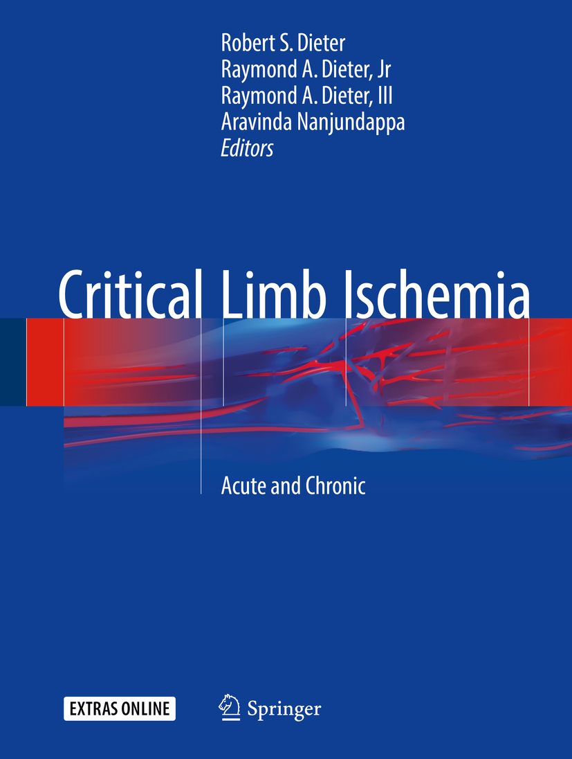Dieter, Robert S. - Critical Limb Ischemia, e-kirja