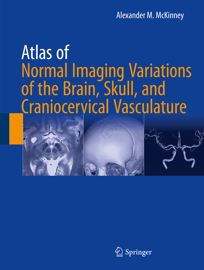 McKinney, Alexander M. - Atlas of Normal Imaging Variations of the Brain, Skull, and Craniocervical Vasculature, e-kirja