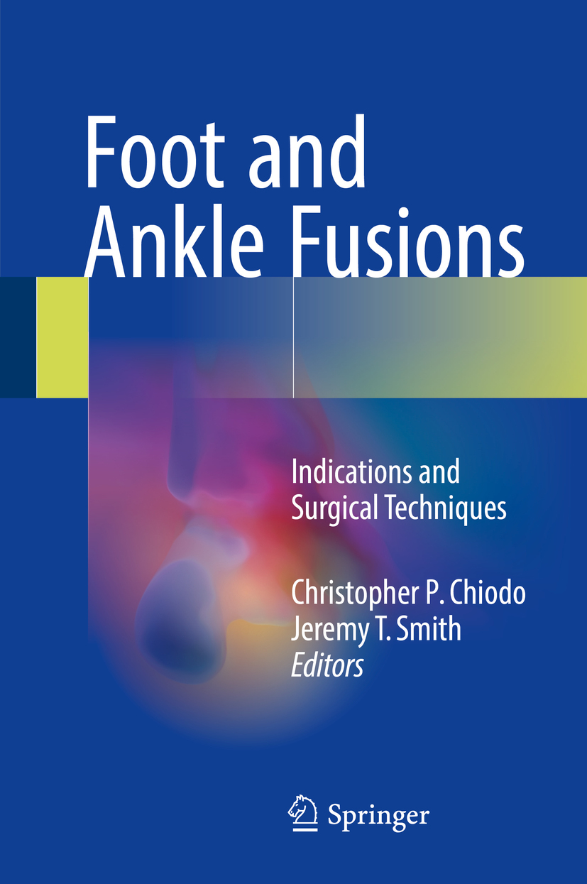Chiodo, Christopher P. - Foot and Ankle Fusions, e-bok