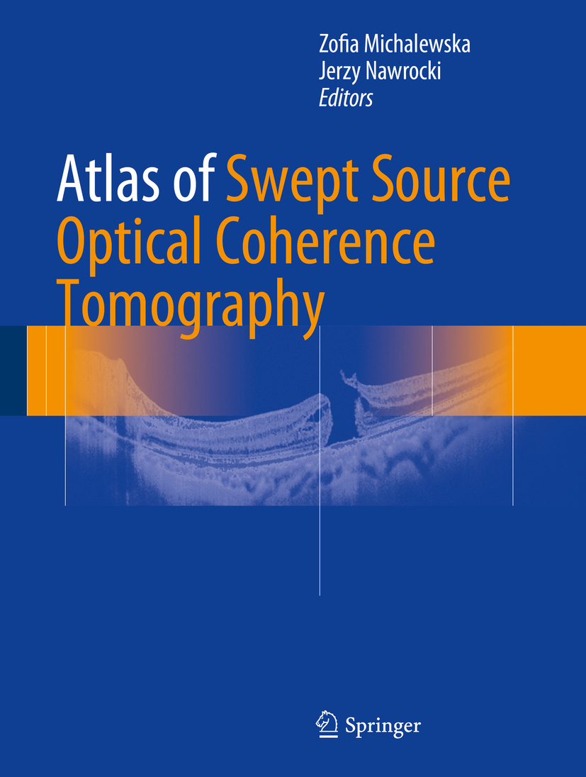 Michalewska, Zofia - Atlas of Swept Source Optical Coherence Tomography, ebook