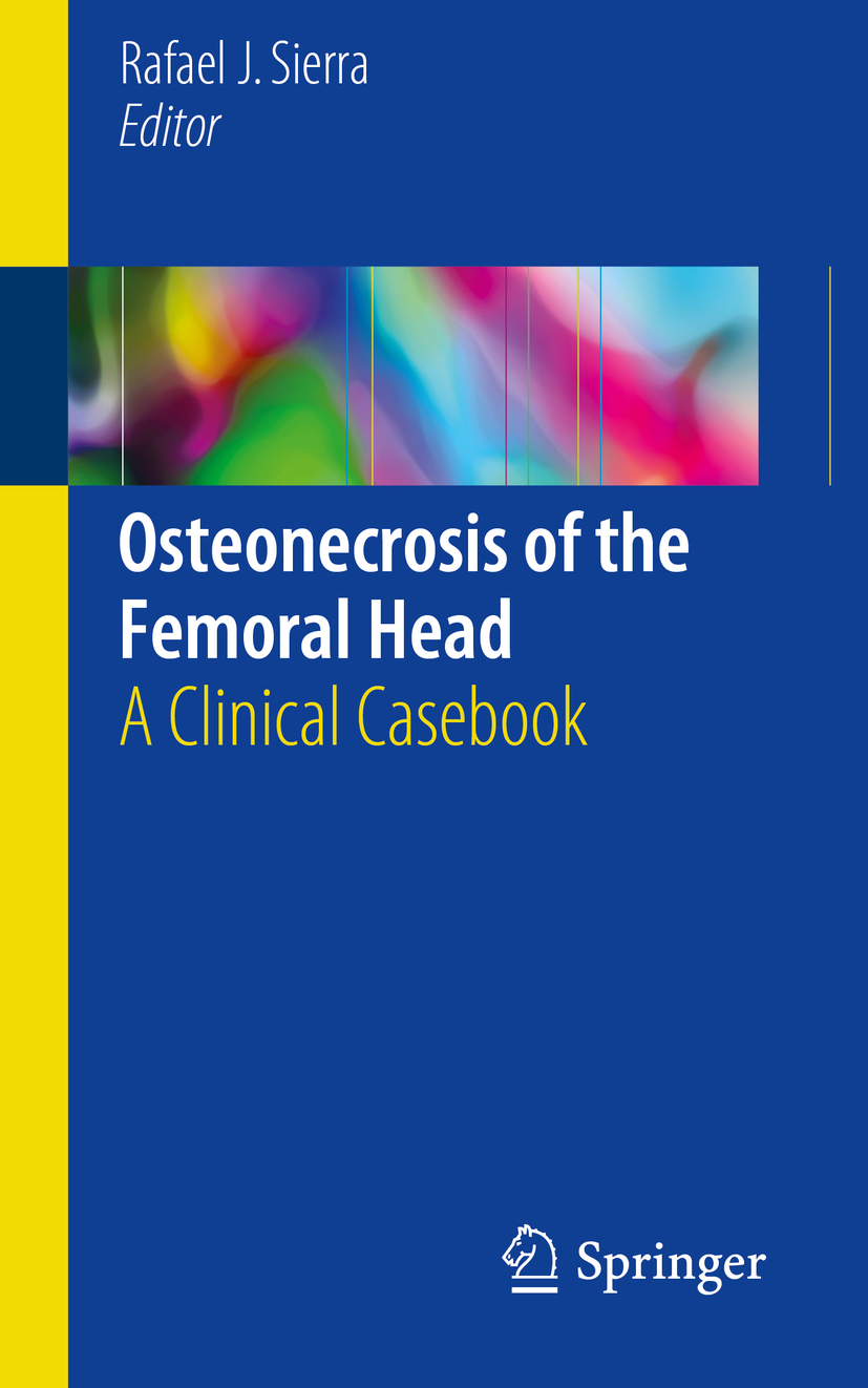 Sierra, Rafael J. - Osteonecrosis of the Femoral Head, e-bok