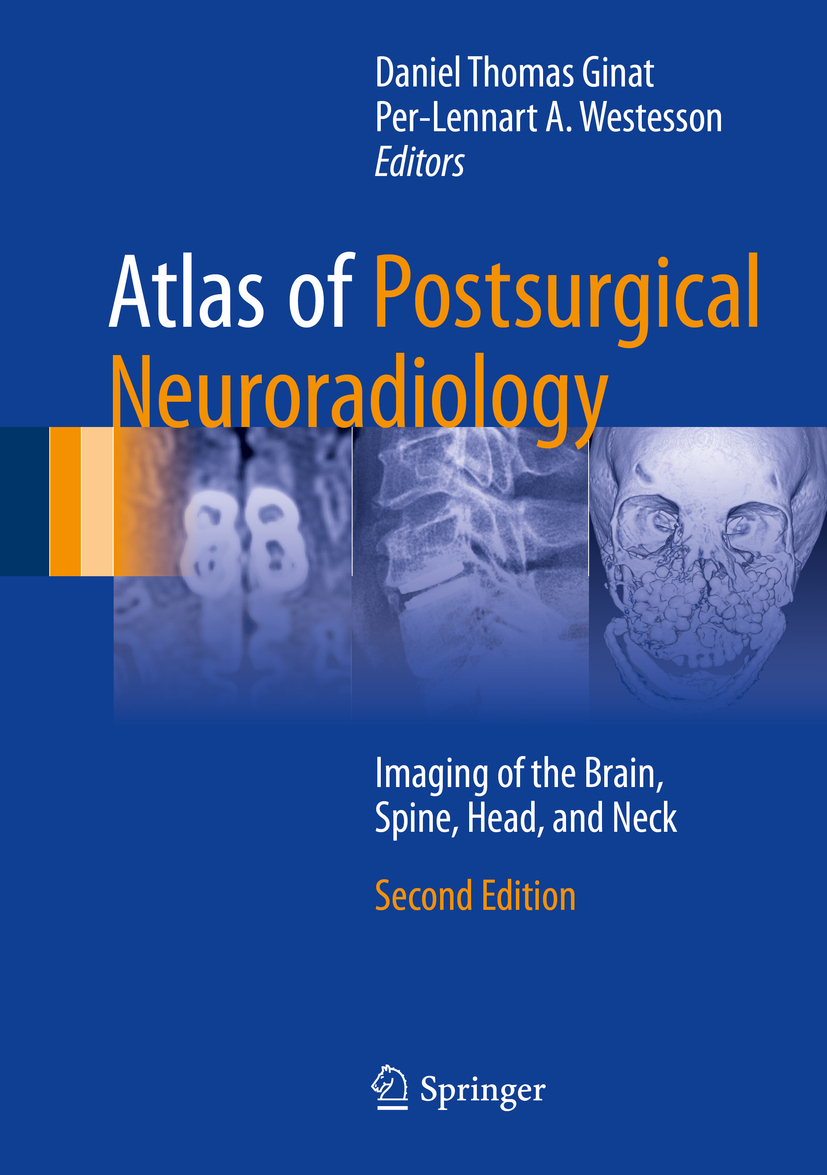Ginat, Daniel Thomas - Atlas of Postsurgical Neuroradiology, e-kirja