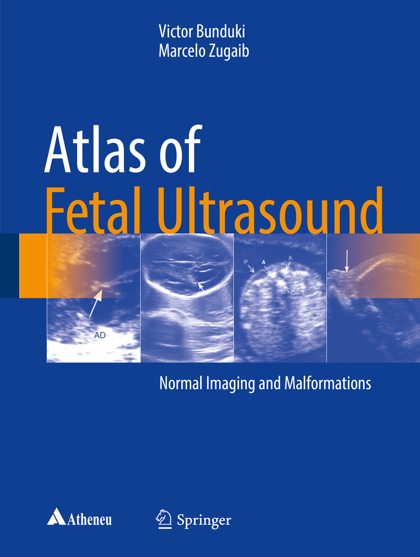 Bunduki, Victor - Atlas of Fetal Ultrasound, e-bok