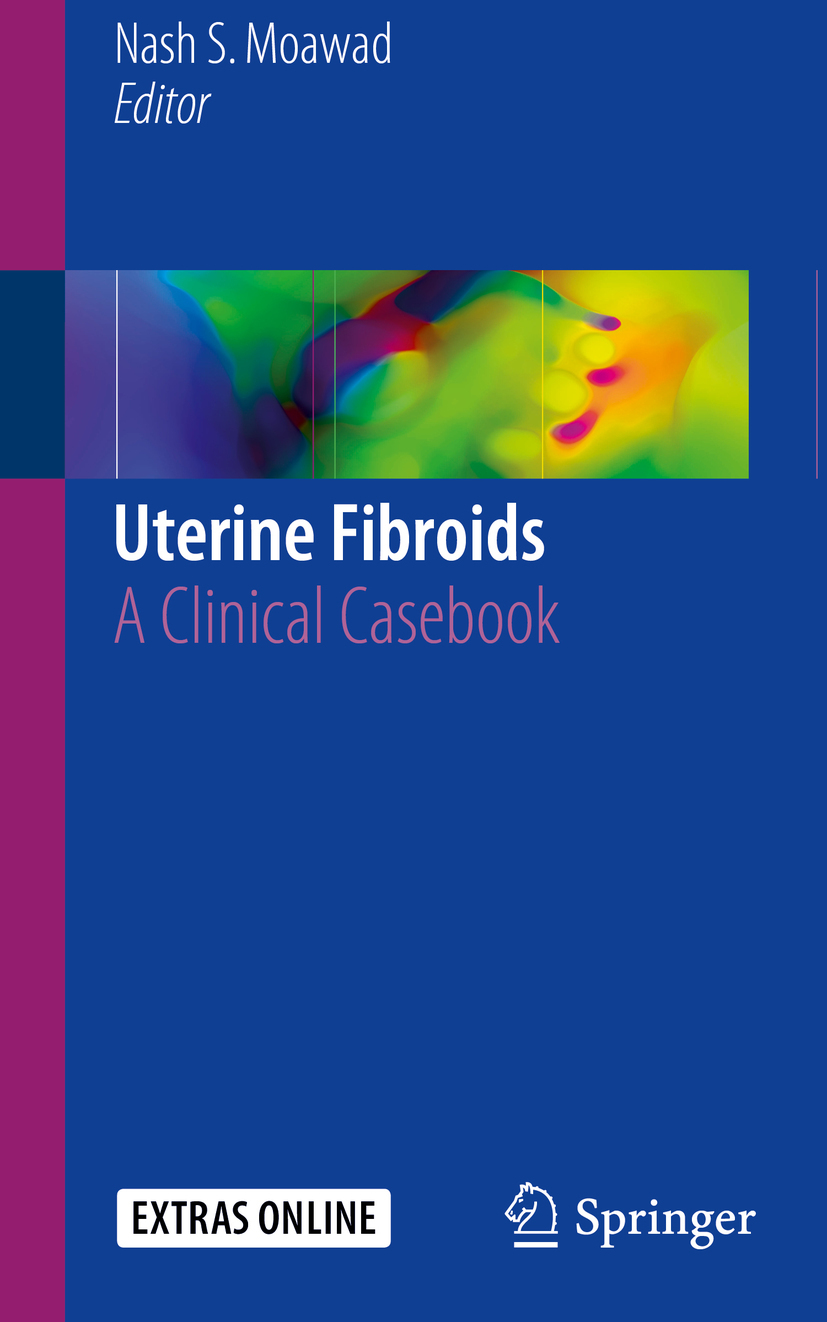 Moawad, Nash S. - Uterine Fibroids, ebook