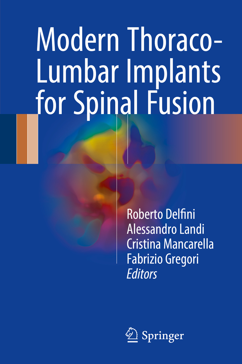 Delfini, Roberto - Modern Thoraco-Lumbar Implants for Spinal Fusion, e-kirja