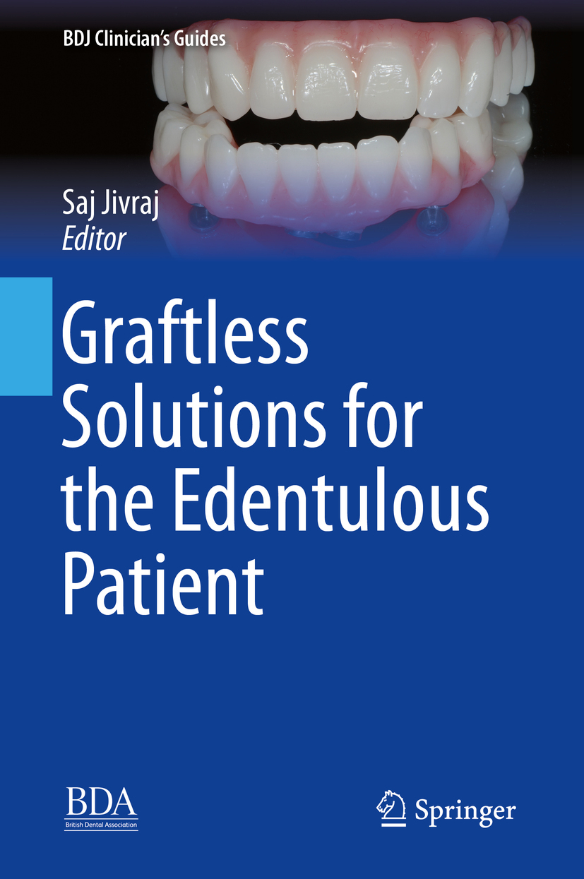 Jivraj, Saj - Graftless Solutions for the Edentulous Patient, ebook
