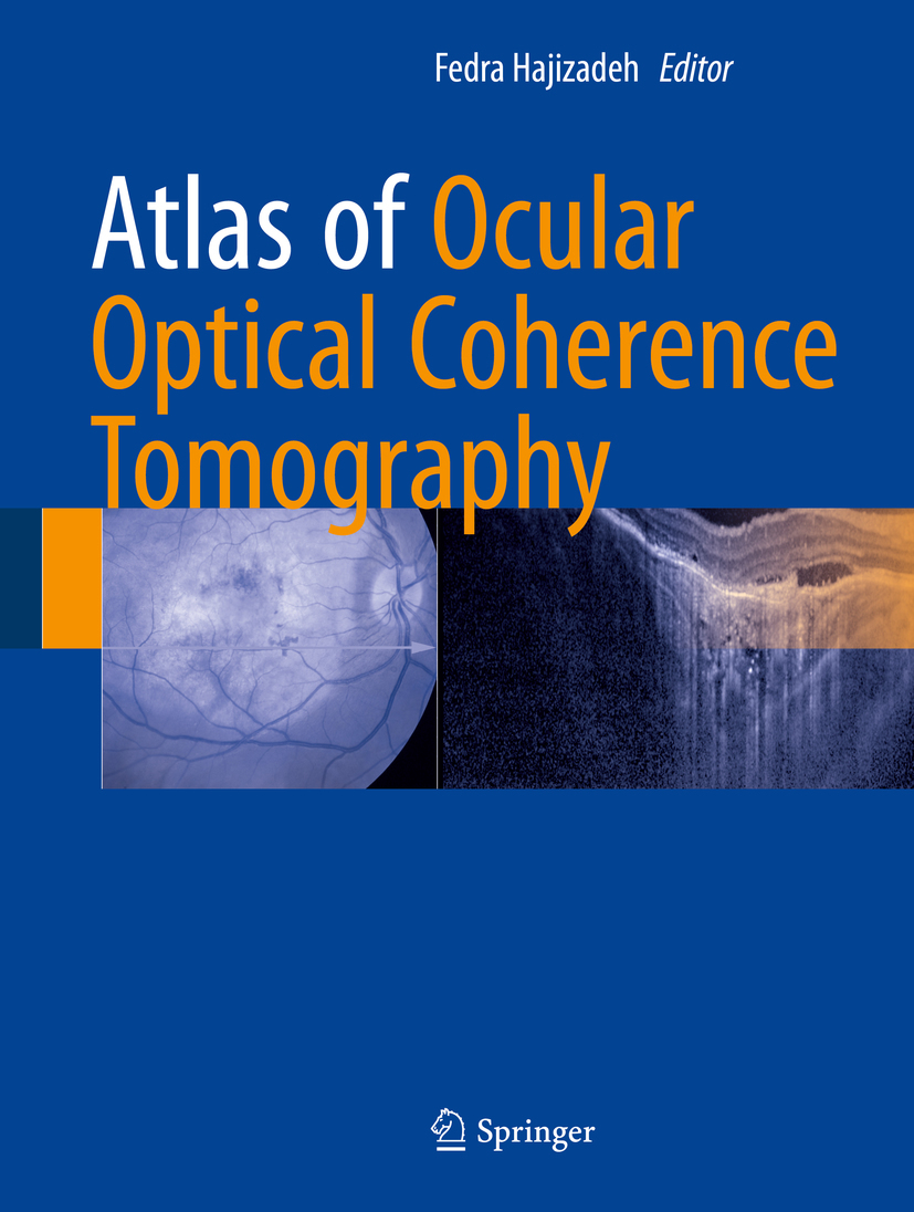 Hajizadeh, Fedra - Atlas of Ocular Optical Coherence Tomography, ebook