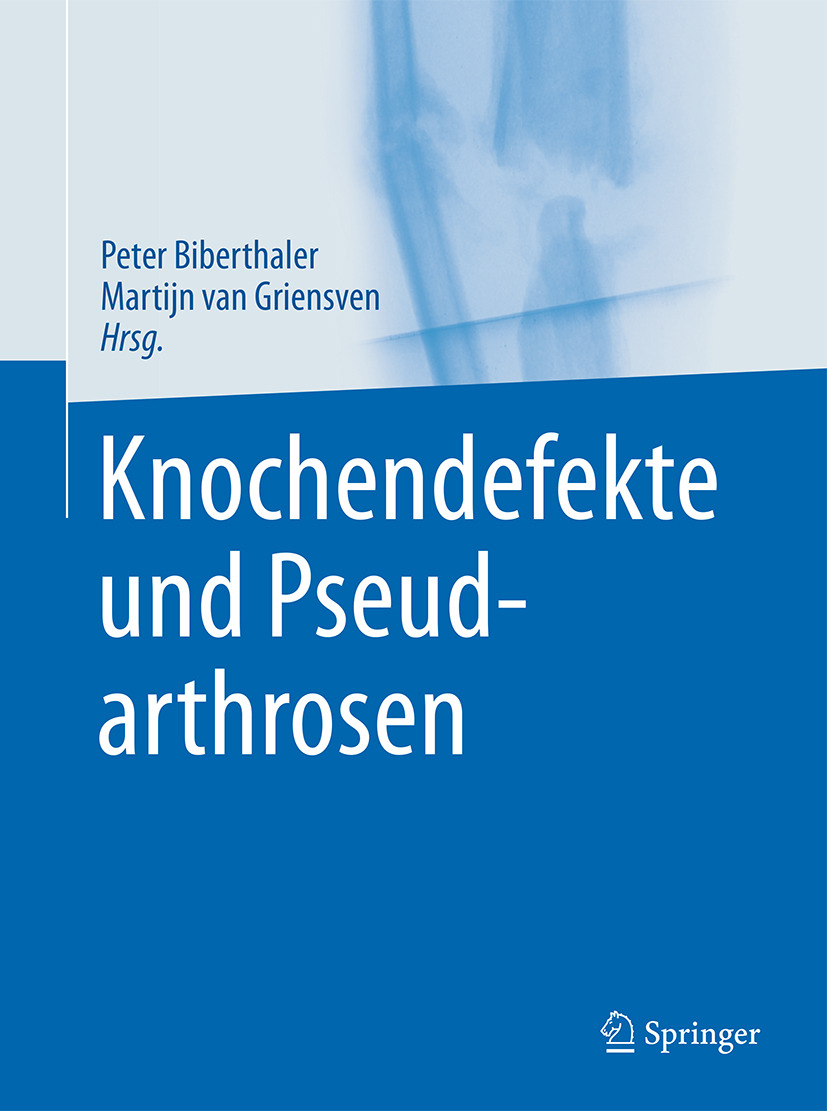 Biberthaler, Peter - Knochendefekte und Pseudarthrosen, e-bok