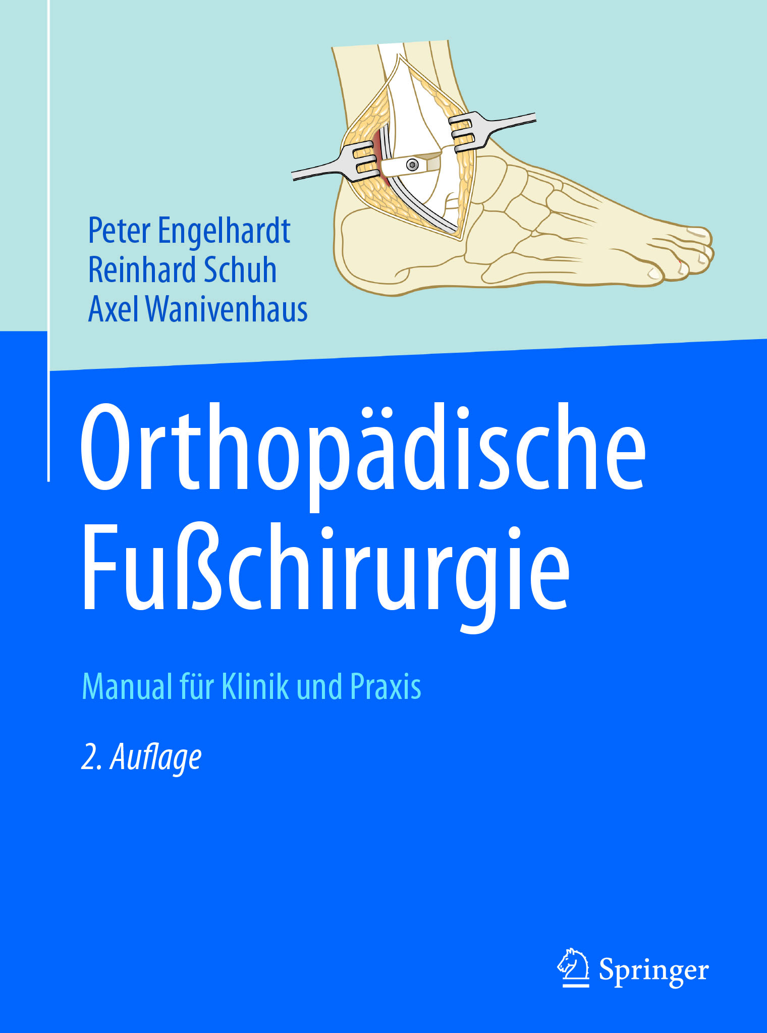Engelhardt, Peter - Orthopädische Fußchirurgie, ebook
