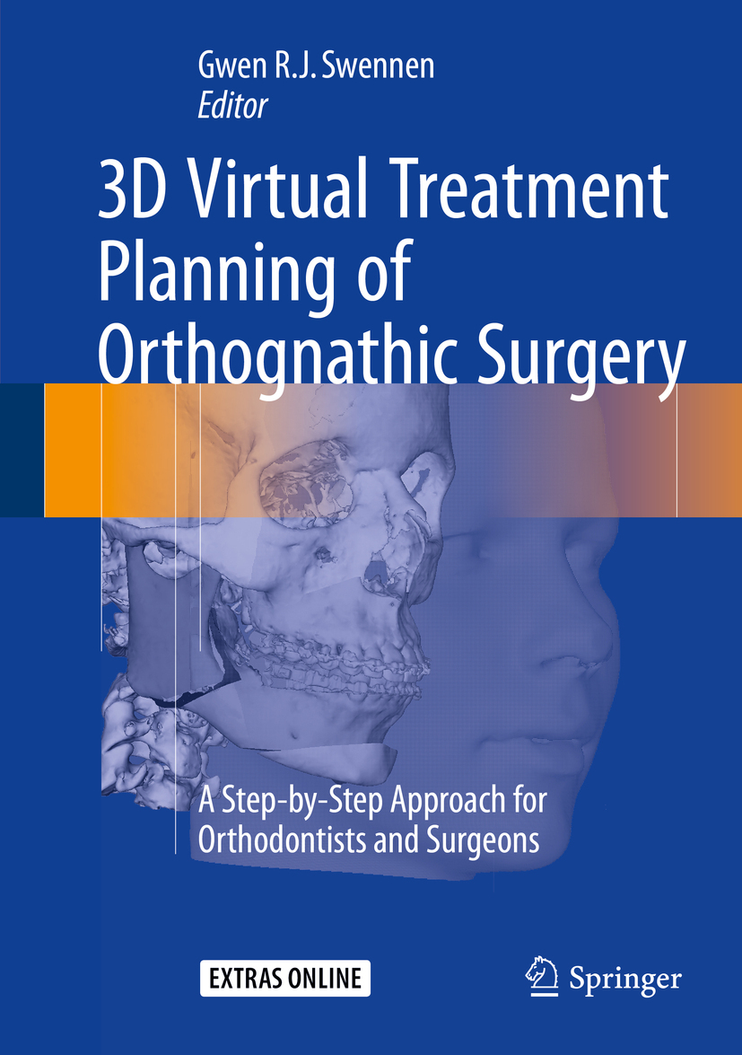 Swennen, Gwen - 3D Virtual Treatment Planning of Orthognathic Surgery, e-bok