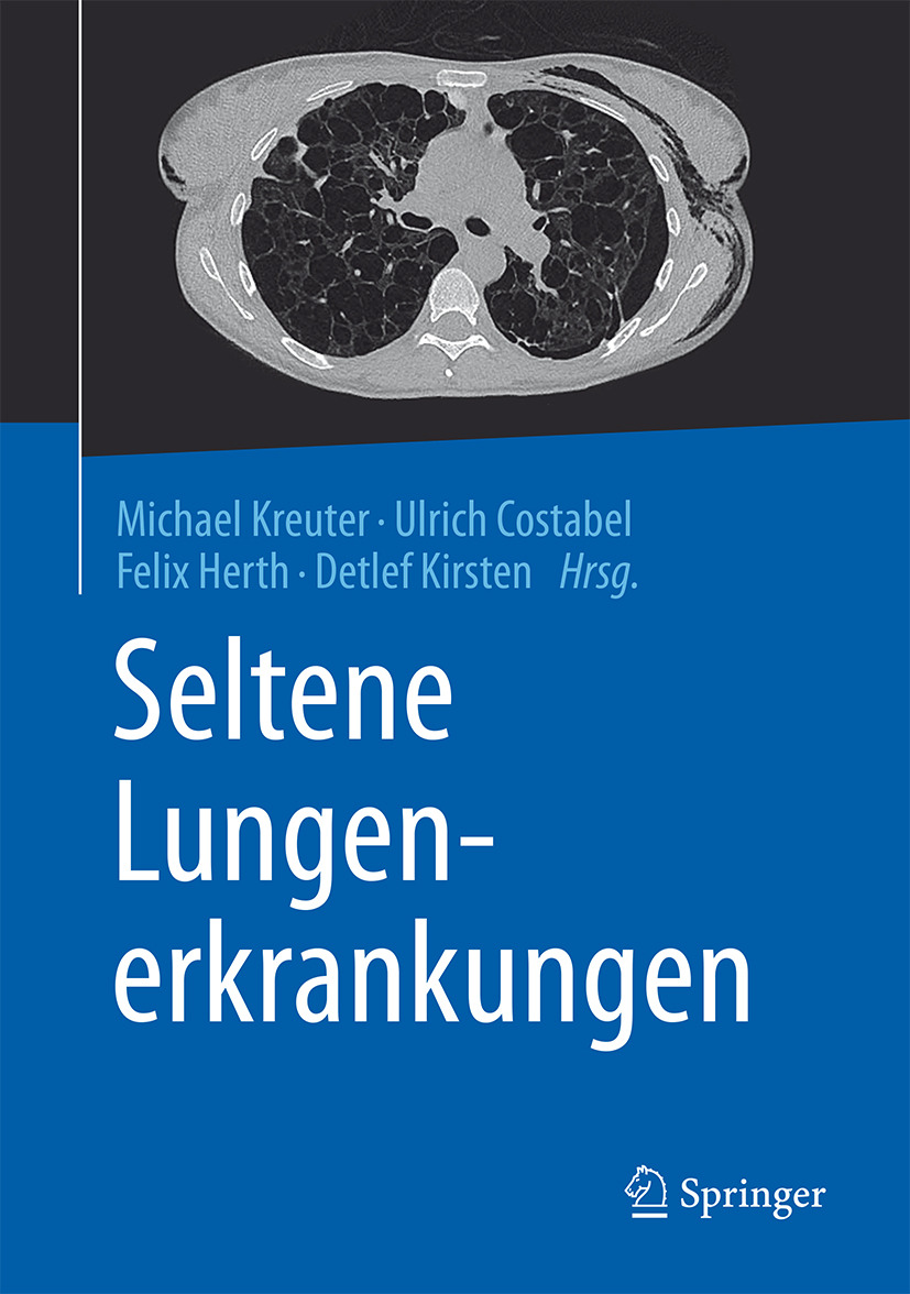 Costabel, Ulrich - Seltene Lungenerkrankungen, e-bok