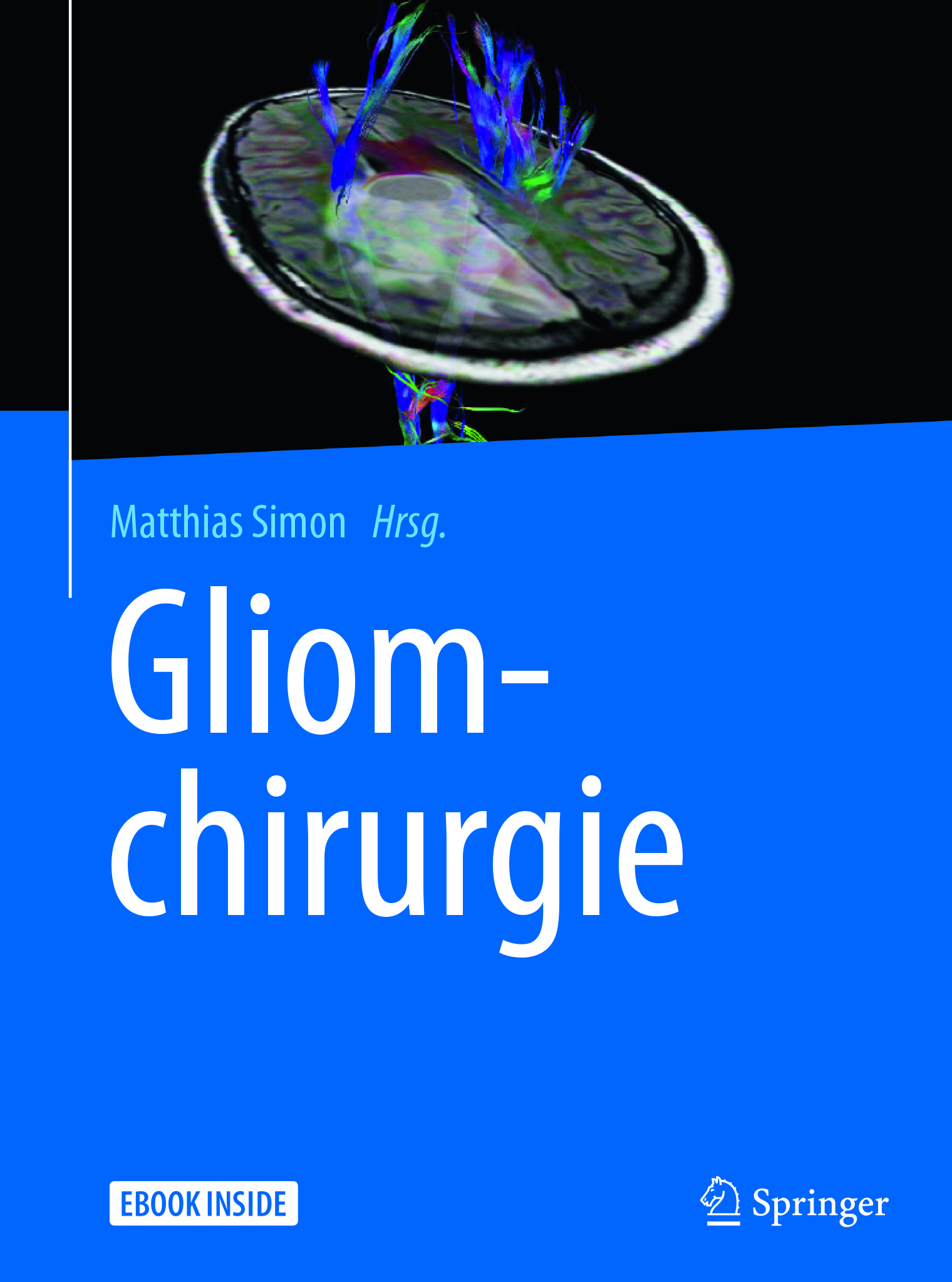 Simon, Matthias - Gliomchirurgie, e-kirja