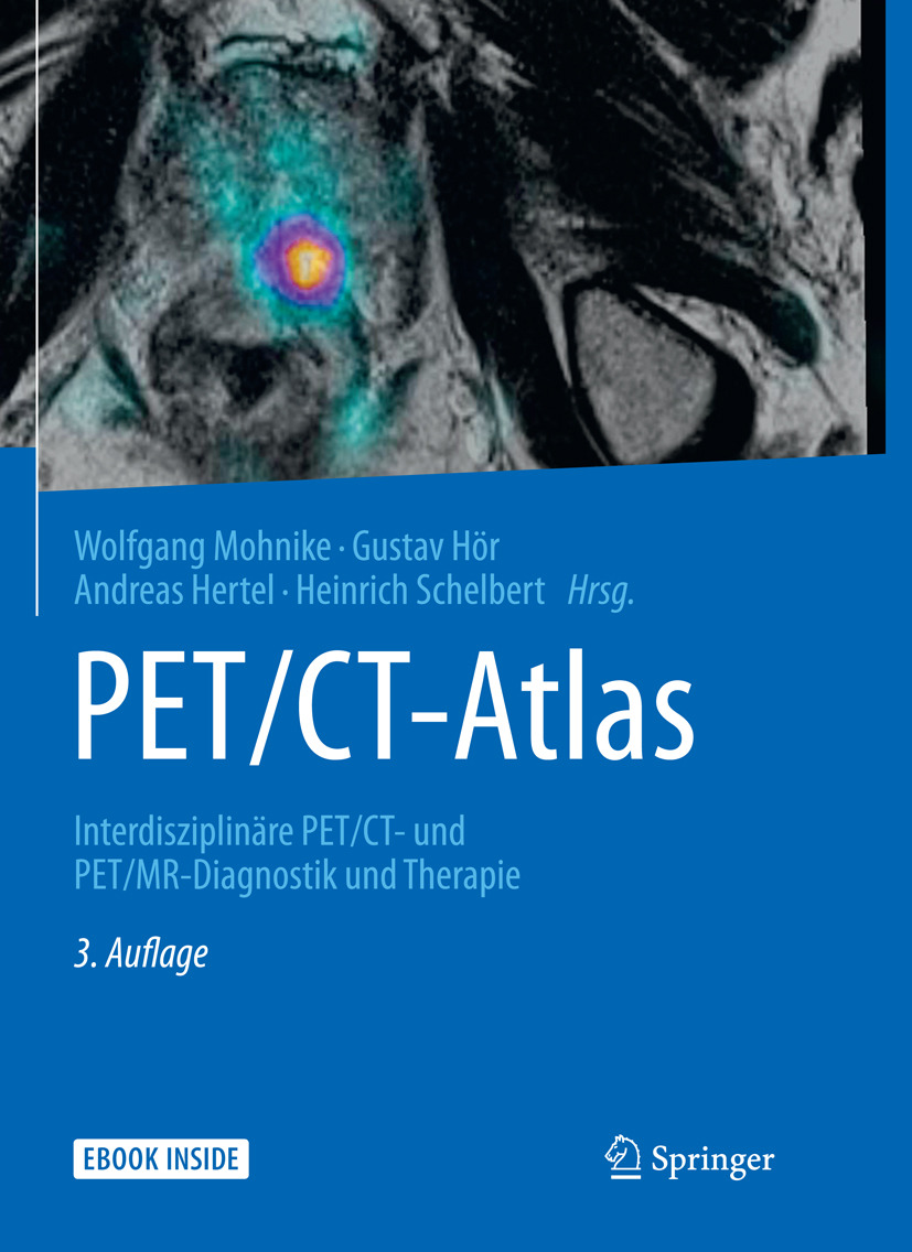 Hertel, Andreas - PET/CT-Atlas, ebook
