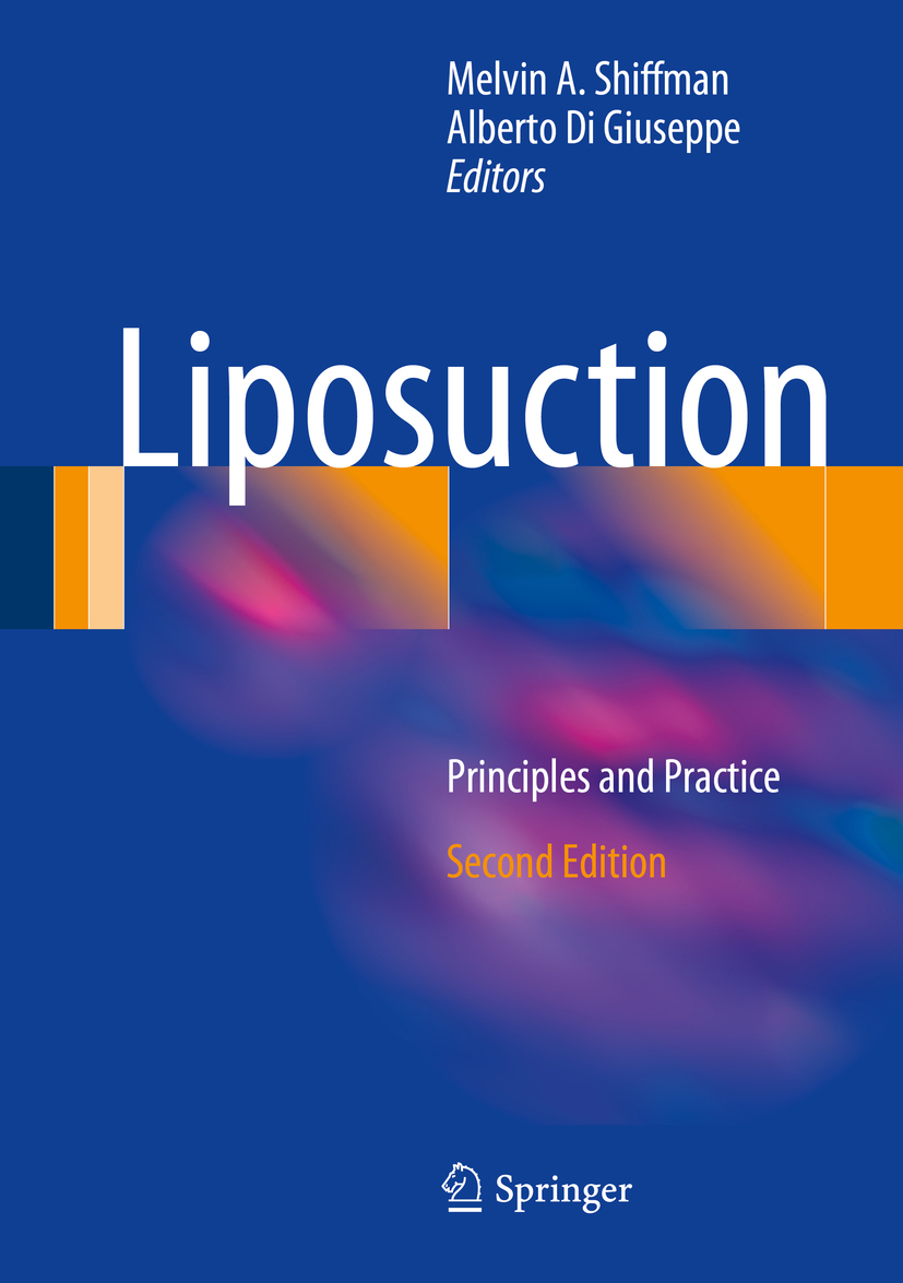 Giuseppe, Alberto Di - Liposuction, ebook