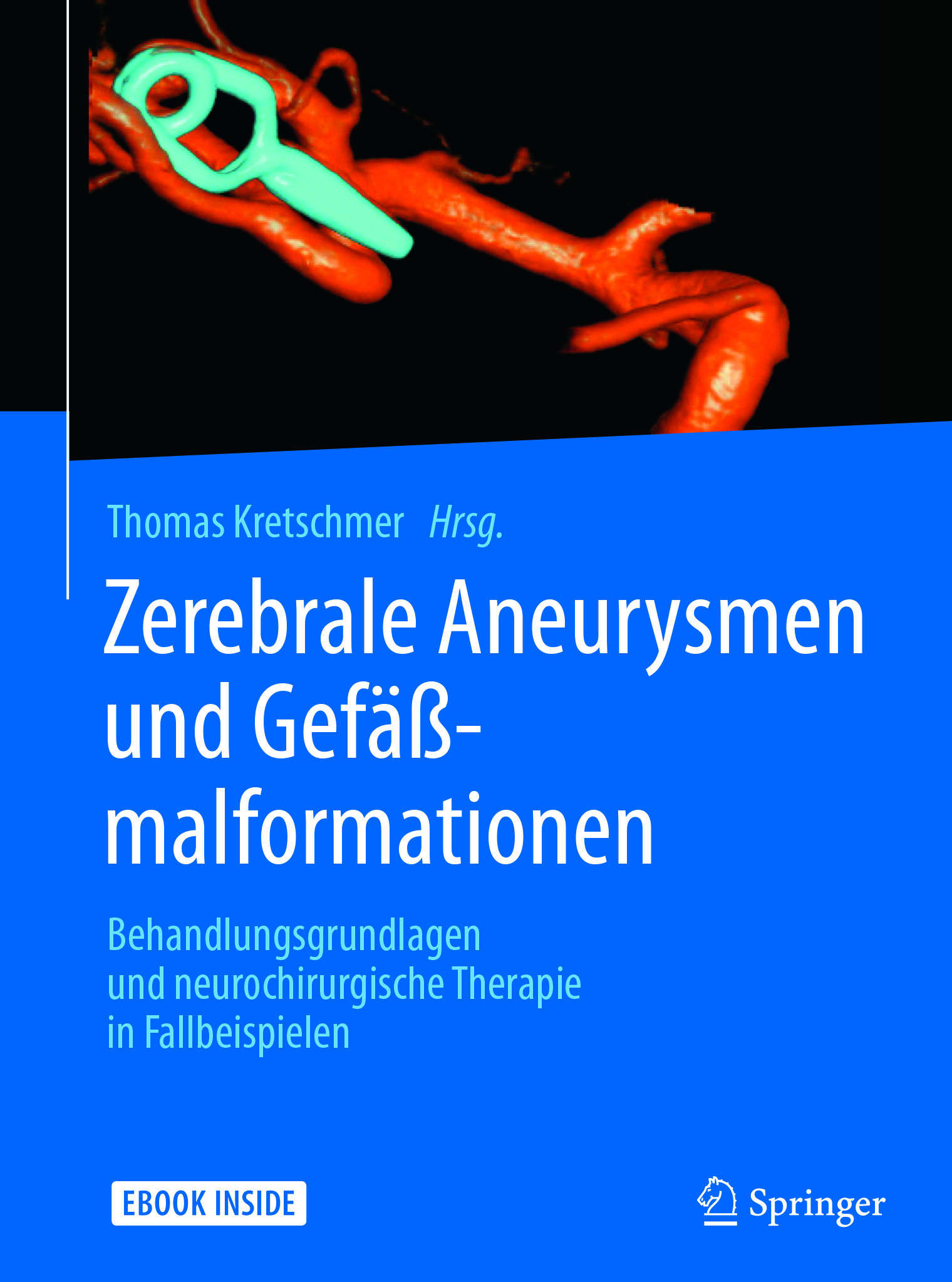 Kretschmer, Thomas - Zerebrale Aneurysmen und Gefäßmalformationen, e-kirja