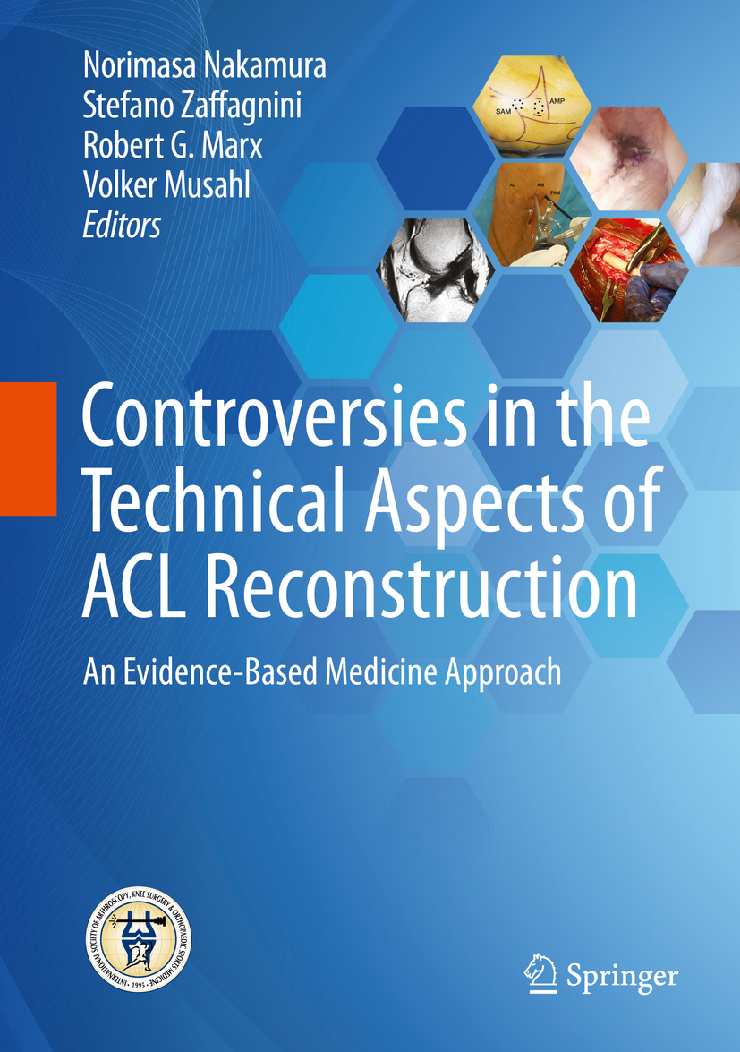 Marx, Robert G. - Controversies in the Technical Aspects of ACL Reconstruction, e-bok