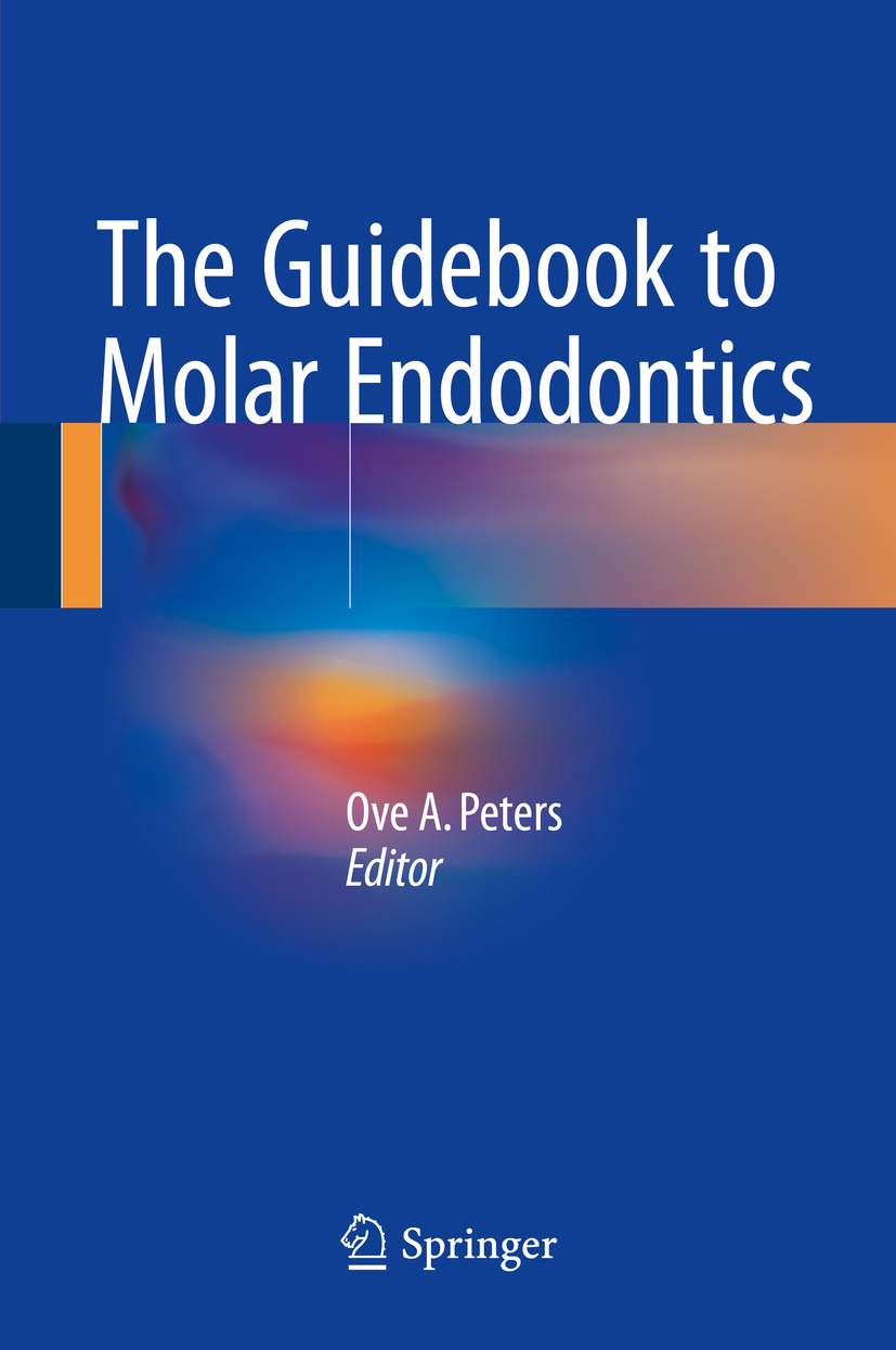 Peters, Ove A. - The Guidebook to Molar Endodontics, ebook