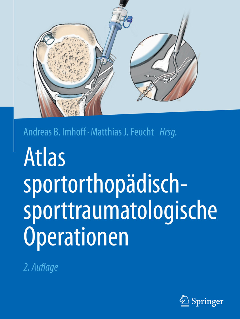 Feucht, Matthias J. - Atlas sportorthopädisch-sporttraumatologische Operationen, ebook