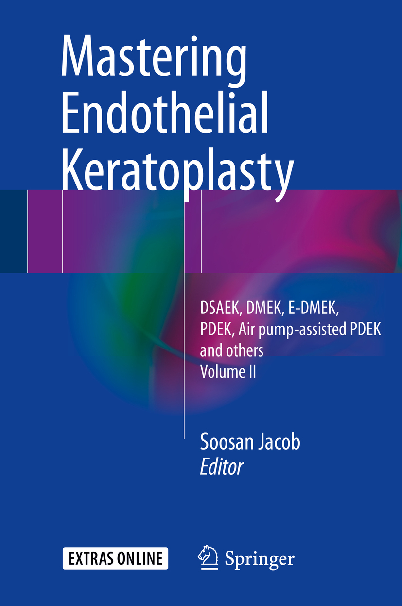 Jacob, Soosan - Mastering Endothelial Keratoplasty, e-bok